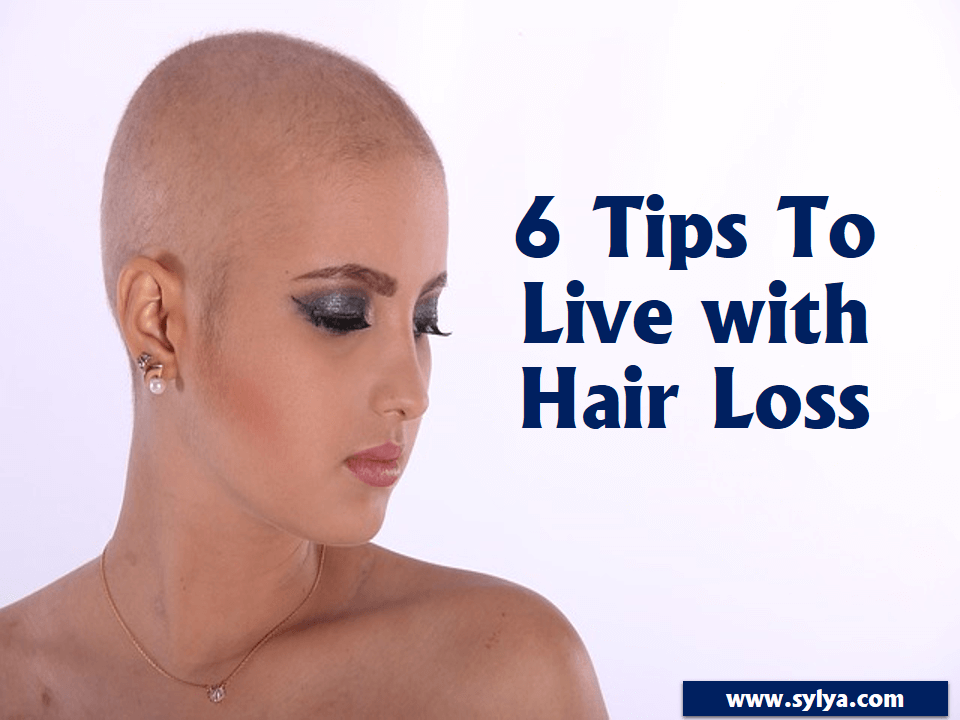 Hair loss solution: Causes and Tips to live with Hair loss